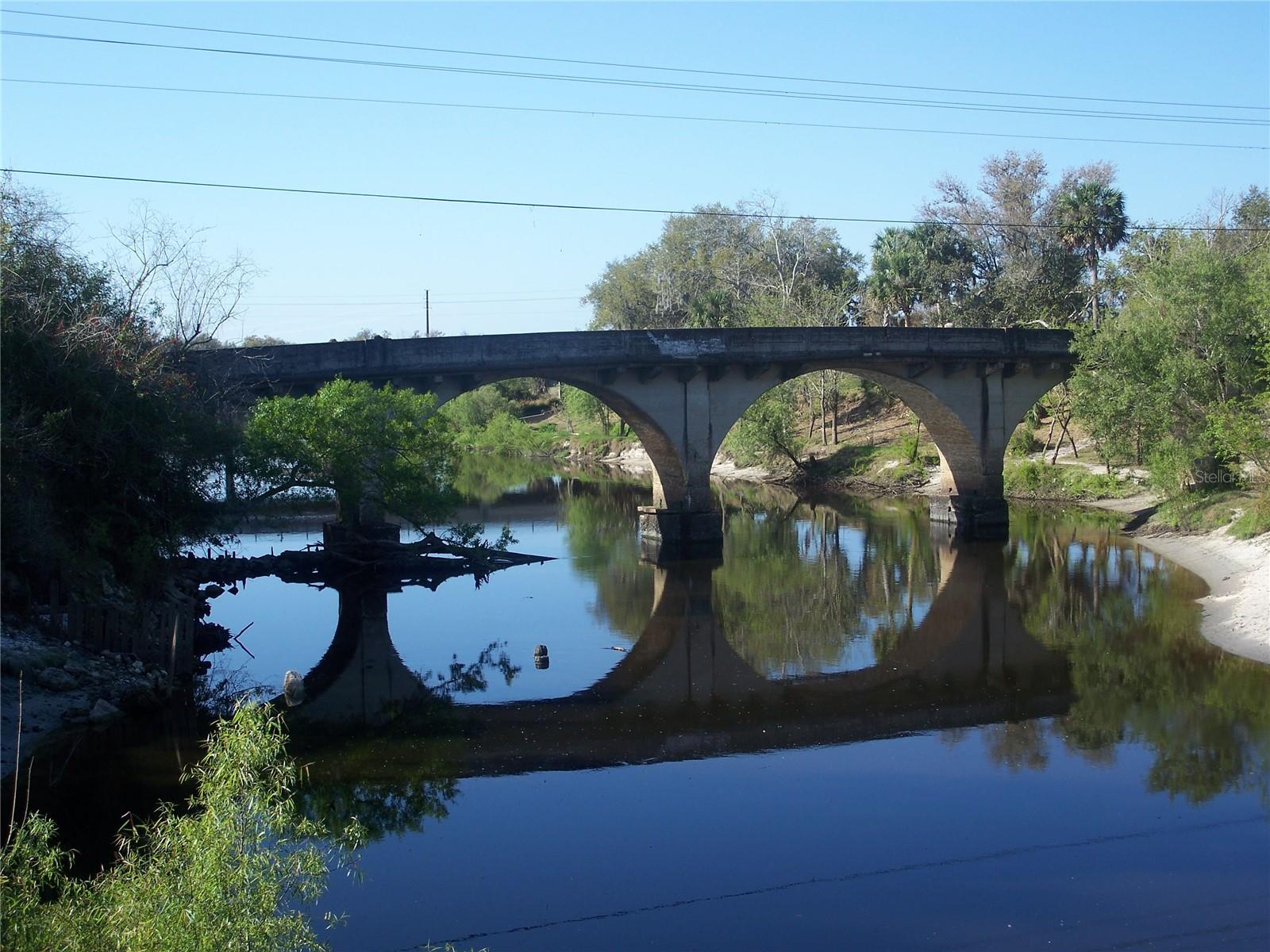 Bridge on shell cheek